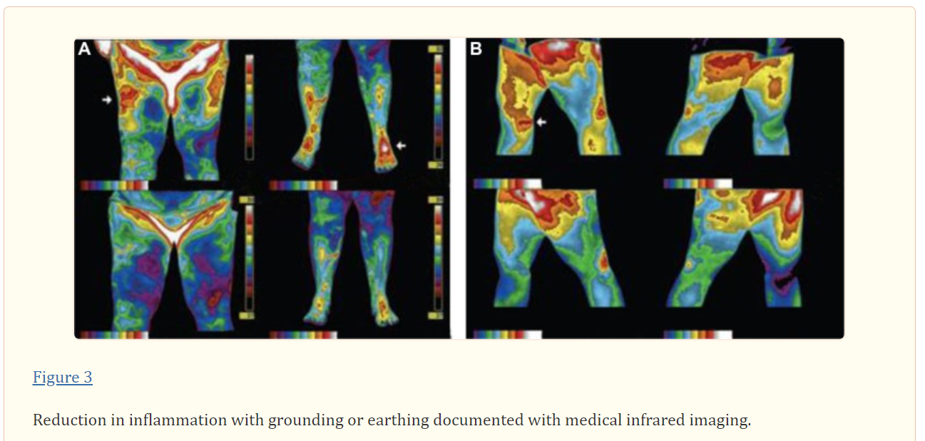 Does Grounding Reduce Inflammation?